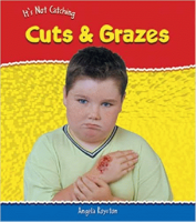 Cuts___grazes